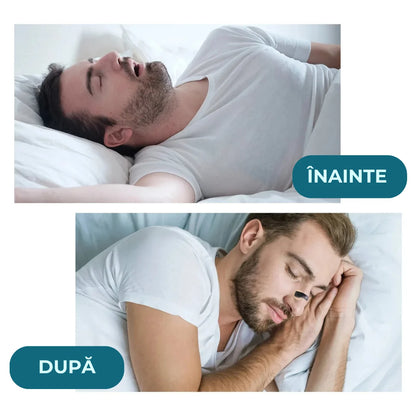 Set 150 Dilatatoare Nazale Magnetice, Anti-Sforăit, Respirație Ușoară