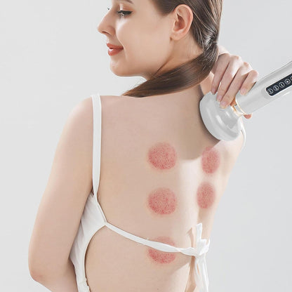 Aparat Electric de Masaj Cupping – Terapie cu Vacuum pentru Relaxare și Remodelare Corporală